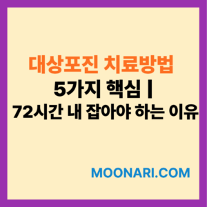 대상포진 치료방법